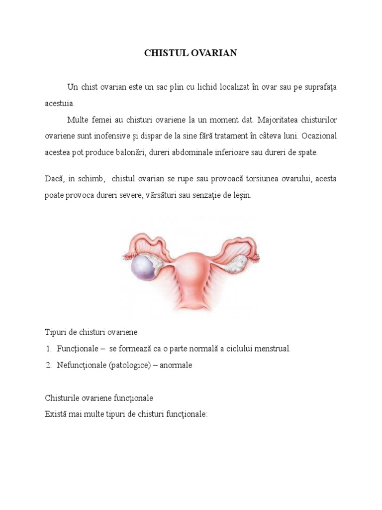Chistul Ovarian | PDF