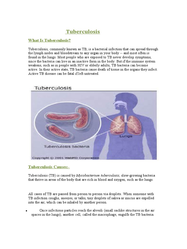 Understanding Tuberculosis: Causes & Symptoms | PDF | Tuberculosis ...