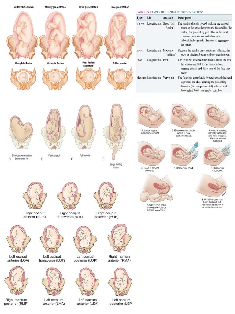 Fetal Position | PDF