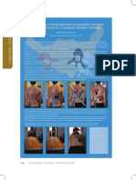 833108.Kiseljak Kinesio Taping in the Rehabilitation of Adolescent Idiopathic Scoliosis