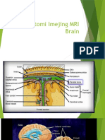 Anatomi Imejing MRI Brain