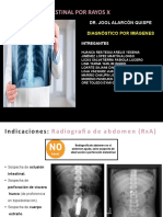 Obstrucción Intestinal