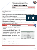 Electrocardiograma