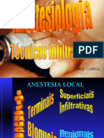 anestesia teorica infiltrativa