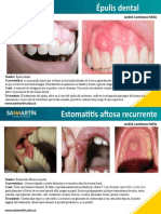 Épulis Dental y Estomatitis Aftosa Recurrente