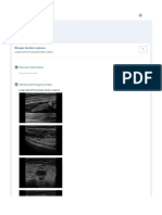 Musculoskeletal Joints and Tendons - 6.1 Shoulder - Case 6.1.2 Long Tendon Biceps Tendon Rupture - Ultrasound Cases