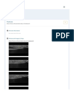 Musculoskeletal Joints and Tendons - 6.8 Foot - Case 6.8.7 Bony Lesions in Thefoot - Ultrasound Cases