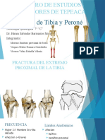Fractura Tibia-Peroné Proyección