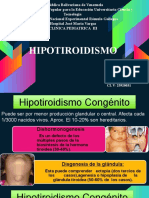 Hipotiroidismo