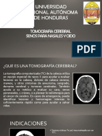 Tomografia Cerebral PDF