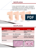 Neoplasia. Seminario Fisiopatologia