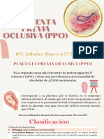 PPO: Diagnóstico, manejo y factores de riesgo de placenta previa oclusiva