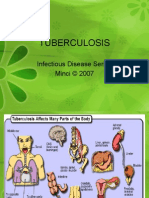 Tuberculosis