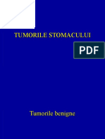 Cancerul Gastric