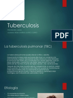 presentacion tuberculosis