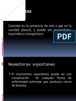 Neumotórax: causas, síntomas y tratamiento de la presencia de aire en la cavidad pleural