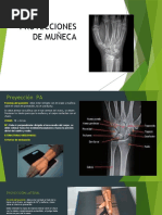 Proyecciones de Pelvis Inlet y Outlet | PDF | Ciencia y matemáticas