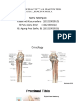 Fraktur Tibia Plateu