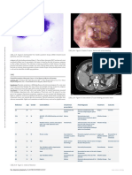 Unusual Presentation of Pancreatic Cancer A Case.1302