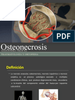 Osteonecrosis Final