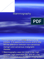 Mammography: A Guide to Breast Imaging