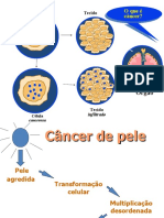 Slide Cancer de Pele