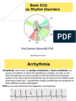 ECG Arrhythmia Guide