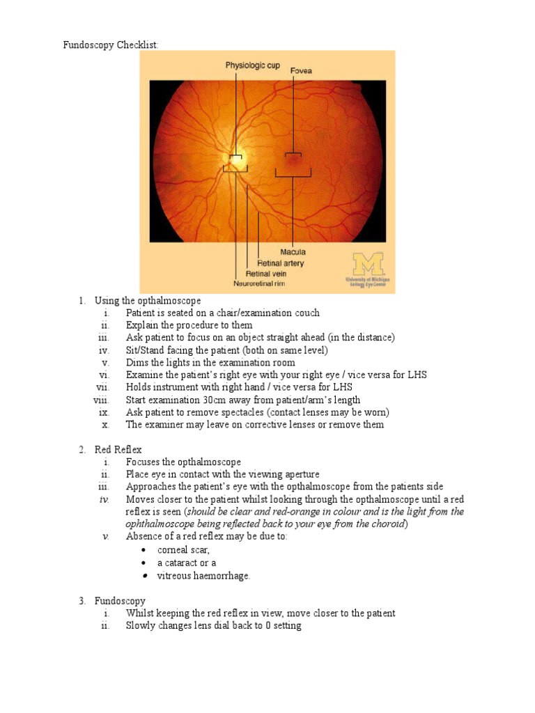 Fundoscopy Examination Checklist Guide | PDF | Retina | Artery