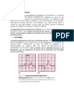 HIPERCALEMIA