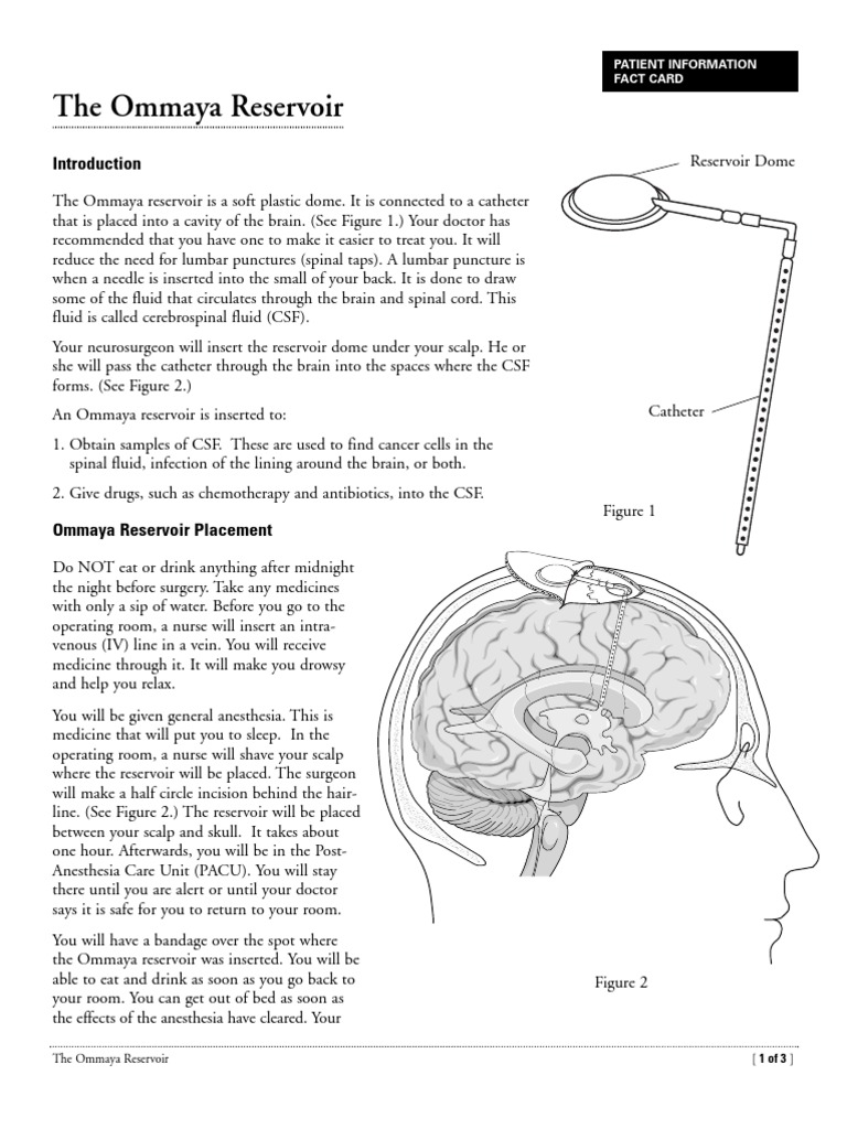 The Ommaya Reservoir Cerebrospinal Fluid Surgery