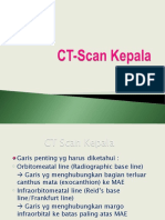 CT Scan Kepala New 2