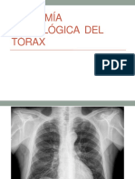 Anatomía Radiológica Del Torax 1
