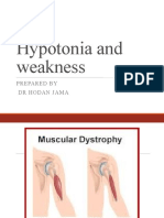 Hypotonia and Weakness: Prepared by DR Hodan Jama