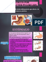 Gastritis Uatf