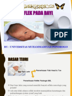 Reflek Pada Bayi