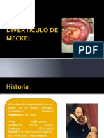 Diverculo de Meckel