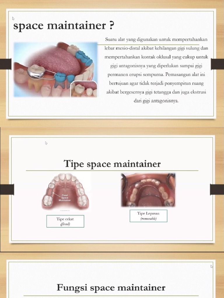 Space Maintainer & Klamer Adam PDF