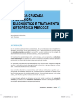 Mordida Cruzada Posterior Diagnóstico e Tratamento Ortopédico Precoce