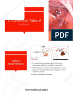 Endometiosis Tutorial: Adult Nursing 2