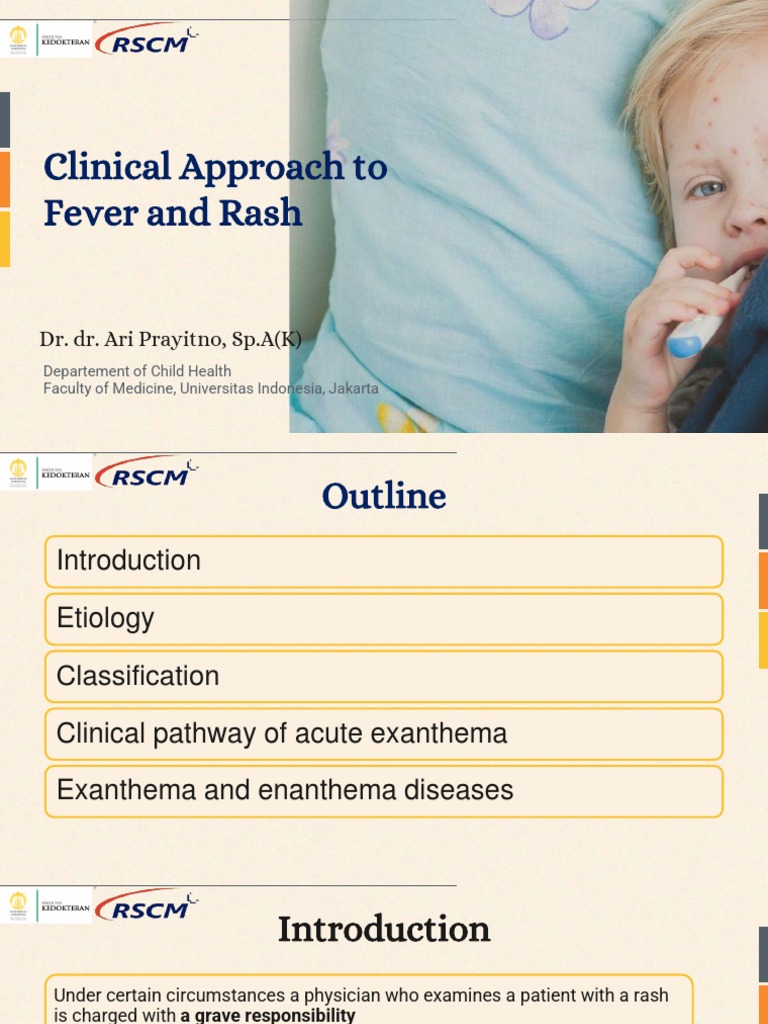 Clinical Approach To Fever and Rash - Dr. Dr. Ari Prayitno, Sp.A (K ...