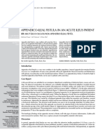 Appendico-Ileal Fistula in An Acute Ileus Patient: Bir Akut İleus Olgusunda Apendiko-İleal Fistül