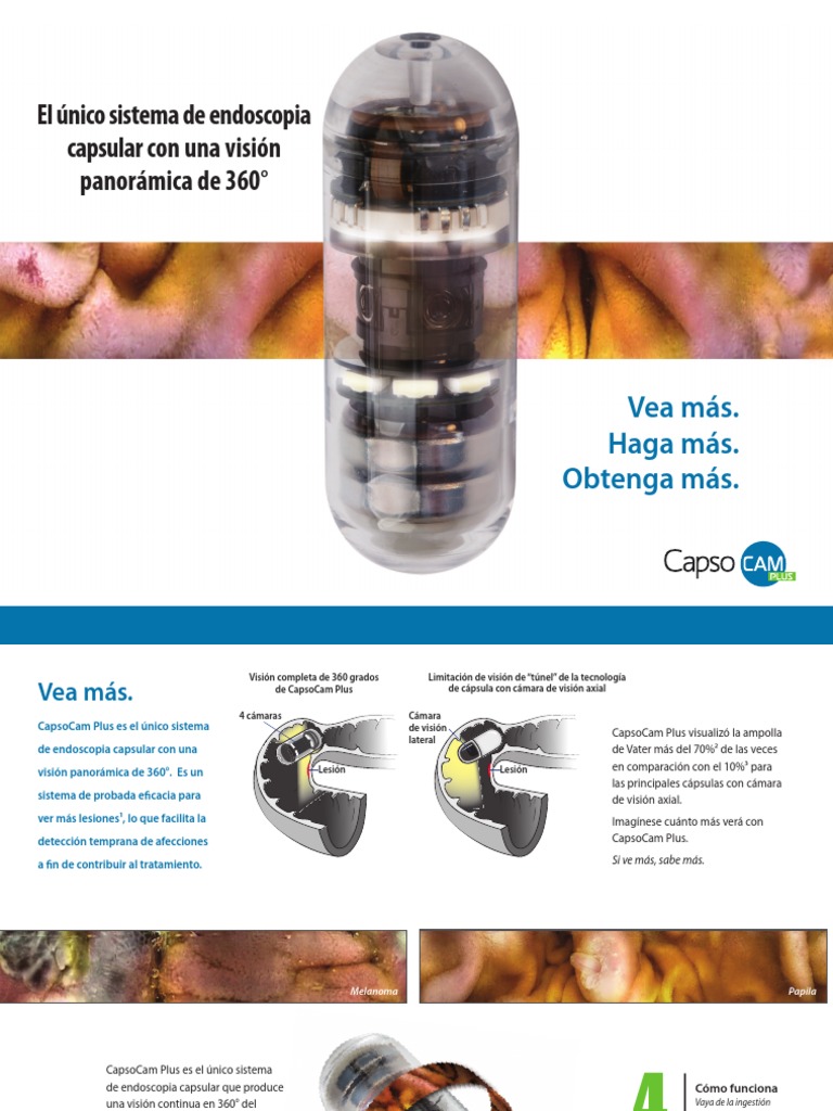 CapsoCamPlus - Brochure - Rev B - Spanish | PDF | Endoscopia ...