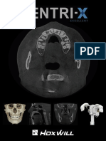 Outstanding Metal Artifact Reduction with DENTRI-X CBCT