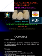 Coronas Veneer
