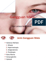 MENGENAL GANGGUAN MATA