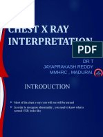 Chest X Ray