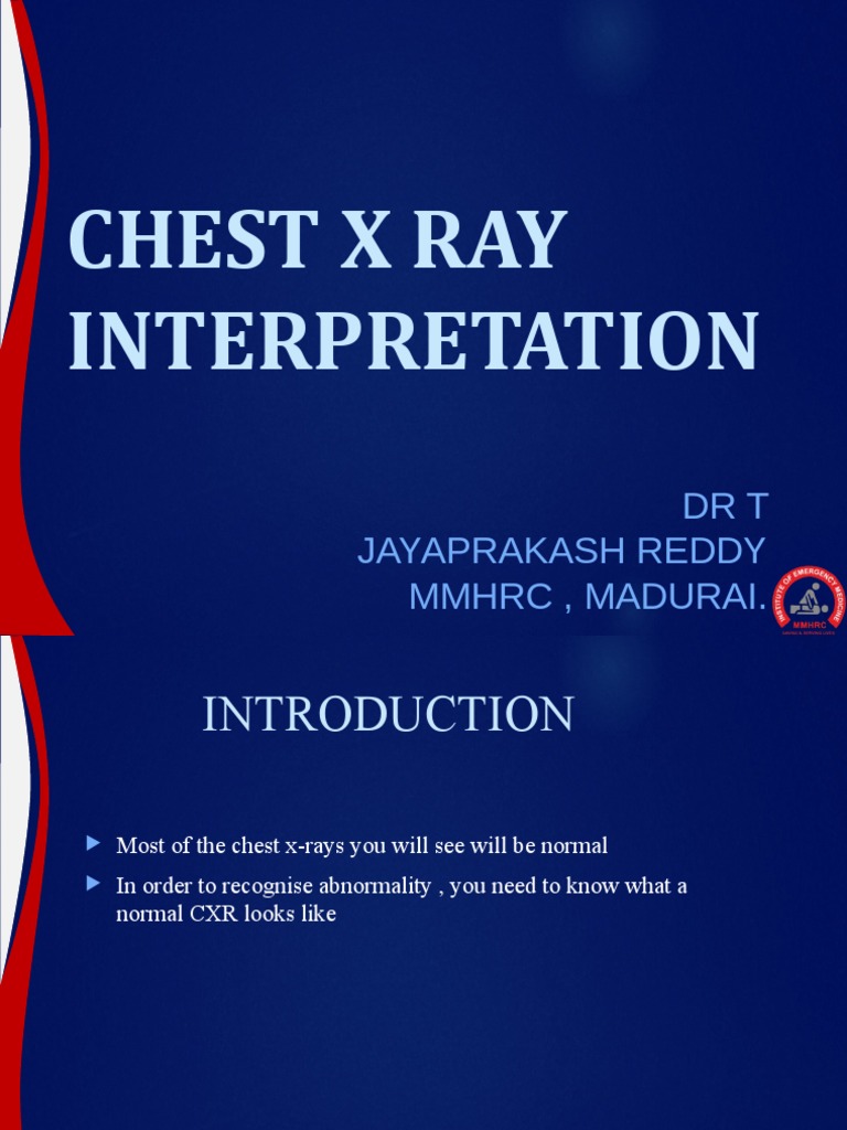 Chest X Ray PDF Thorax Lung