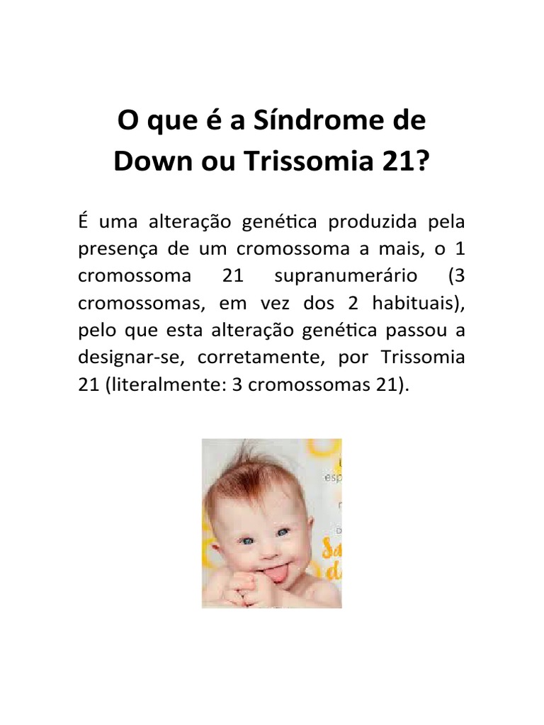 O que é a Síndrome de Down ou Trissomia 21 | PDF