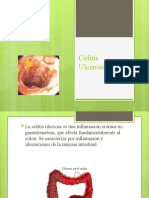 Colitis