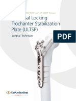 Universal Locking Trochanter Stabilization Plate (ULTSP) : Surgical Technique